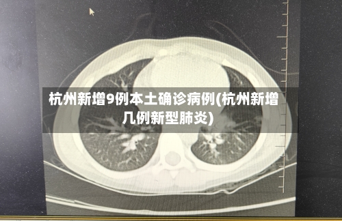 杭州新增9例本土确诊病例(杭州新增几例新型肺炎)-第2张图片