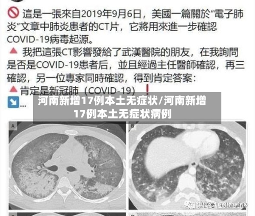 河南新增17例本土无症状/河南新增17例本土无症状病例