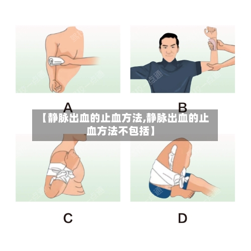 【静脉出血的止血方法,静脉出血的止血方法不包括】-第3张图片
